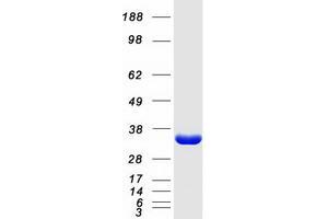 Validation with Western Blot (Ketohexokinase Protein (KHK) (Transcript Variant A) (Myc-DYKDDDDK Tag))