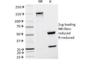 SDS-PAGE Analysis Purified TYRP1 Mouse Monoclonal Antibody (TA99). (Tyrosinase-Related Protein 1 antibody)