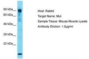 Image no. 1 for anti-Methylmalonyl Coenzyme A Mutase (MUT) (AA 44-93) antibody (ABIN6750352) (MUT antibody  (AA 44-93))