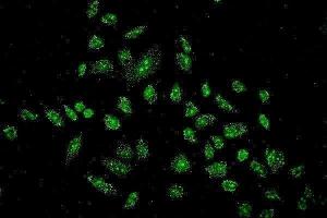 IF analysis of STAT6 using anti-STAT6 antibody (ABIN7600129).