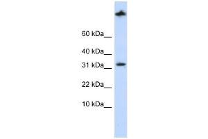 SCP2 antibody used at 1 ug/ml to detect target protein. (SCP2 antibody  (Middle Region))