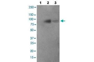 Western blot analysis of Lane 1: antigen-specific peptide treated JK cells, Lane 2: JK cells cells, Lane 3: COS-7 cells with FER (phospho Y402) polyclonal antibody  at 1:500-1:1000 dilution.
