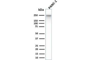 Western Blot Analysis of PANC-1 cell lysate using Spectrin beta III Monoclonal Antibody (SPTBN2/1584). (Spectrin, Beta, Non-erythrocytic 2 (SPTBN2) (AA 356-475) antibody)