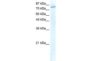 WB Suggested Anti-GTF3C3 Antibody Titration:  1. (GTF3C3 antibody  (N-Term))