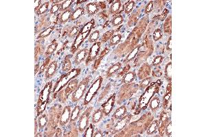 Immunohistochemistry of paraffin-embedded rat kidney using Carbonic Anhydrase 2 (C) Rabbit mAb (ABIN7266070) at dilution of 1:100 (40x lens). (CA2 antibody)