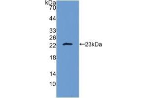 Western blot analysis of recombinant Human IL10. (IL-10 antibody  (AA 19-178))