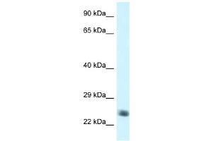 Western Blot showing NDUFS8 antibody used at a concentration of 1 ug/ml against Jurkat Cell Lysate (NDUFS8 antibody  (C-Term))