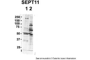 Sample Type: 1. (Septin 11 antibody  (N-Term))
