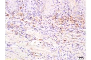 Formalin-fixed and paraffin embedded rat tongue labeled with Anti-IL-20R alpha/IL20RA Polyclonal Antibody, Unconjugated (ABIN748103) at 1:200 followed by conjugation to the secondary antibody (IL20RA antibody  (AA 135-171))