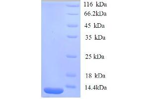 SDS-PAGE (SDS) image for Trefoil Factor 1 (TFF1) (AA 25-84) protein (His tag) (ABIN7478964)