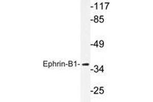 Western blot analysis of Ephrin-B1 antibody in extracts from COS7 cells. (Ephrin B1 antibody)
