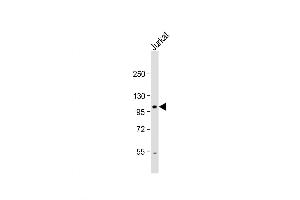 Western Blot at 1:1000 dilution + Jurkat whole cell lysate Lysates/proteins at 20 ug per lane. (Unc5c antibody  (N-Term))