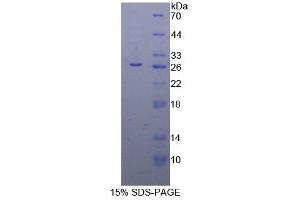 SDS-PAGE analysis of Human Elastin Protein.