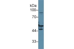 Western blot analysis of Human HeLa cell lysate, using Human KRT16 Antibody (2 µg/ml) and HRP-conjugated Goat Anti-Rabbit antibody (