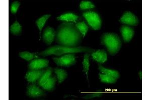 Immunofluorescence of monoclonal antibody to RDX on HeLa cell. (Radixin antibody  (AA 1-583))