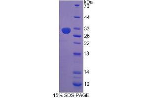 SDS-PAGE analysis of Rat COL9a1 Protein. (COL9A1 Protein)