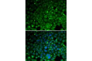 Immunofluorescence analysis of HeLa cell using CRYAA antibody. (CRYAA antibody)