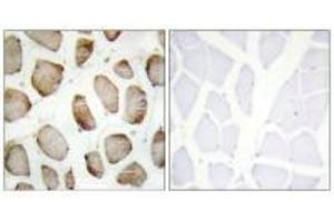 Immunohistochemistry analysis of paraffin-embedded human skeletal muscle using DUS2L antibody. (DUSL2 antibody  (C-Term))