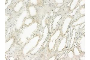 ABIN6264124 and ABIN6277517 at 1/100 staining human normal kidney tissue by IHC-P. (PDZK1 antibody  (C-Term))