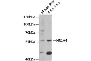 Western blot analysis of extracts of various cell lines, using NR1H4 antibody (ABIN6127919, ABIN6144801, ABIN6144803 and ABIN6216539) at 1:1000 dilution. (NR1H4 antibody  (AA 207-476))