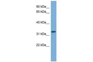 WB Suggested Anti-ATG3 Antibody Titration: 0. (ATG3 antibody  (Middle Region))