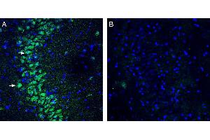 Expression of KCNMB3 in rat hippocampus.