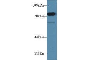 Western Blotting (WB) image for anti-CD2-Associated Protein (Cd2ap) (AA 368-623) antibody (ABIN7439519)