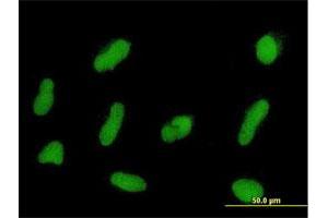 Immunofluorescence of purified MaxPab antibody to ZNF254 on HepG2 cell. (ZNF254 antibody  (AA 1-659))