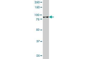 HIC1 monoclonal antibody (M02), clone 2F9 Western Blot analysis of HIC1 expression in Jurkat . (HIC1 antibody  (AA 396-453))