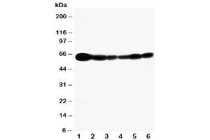 Western blot testing of SHC antibody and Lane 1:  rat brain (SHC1 antibody  (C-Term))