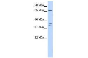 IQCE antibody used at 1 ug/ml to detect target protein. (IQCE antibody  (Middle Region))