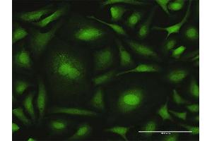 Immunofluorescence of purified MaxPab antibody to CALML6 on HeLa cell. (CALML6 antibody  (AA 1-181))