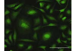 Immunofluorescence of purified MaxPab antibody to CALML6 on HeLa cell. (CALML6 antibody  (AA 1-181))