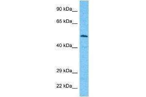 Host:  Rabbit  Target Name:  ALG9  Sample Type:  Jurkat Whole Cell lysates  Antibody Dilution:  1.
