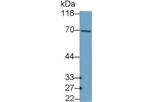Detection of COL10 in MCF7 cell lysate using Polyclonal Antibody to Collagen Type X (COL10) (COL10 antibody  (AA 547-680))