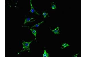 Immunofluorescent analysis of U251 cells using ABIN7172399 at dilution of 1:100 and Alexa Fluor 488-congugated AffiniPure Goat Anti-Rabbit IgG(H+L) (TCN2 antibody  (AA 1-200))