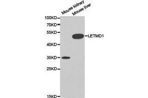 Western Blotting (WB) image for anti-LETM1 Domain Containing 1 (LETMD1) antibody (ABIN1873537) (LETMD1 antibody)