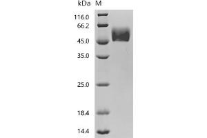 (Tris-Glycine gel) Discontinuous SDS-PAGE (reduced) with 5 % enrichment gel and 15 % separation gel.