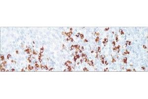 Image no. 1 for Rabbit anti-Human IgD (Chain delta) antibody (ABIN952831)