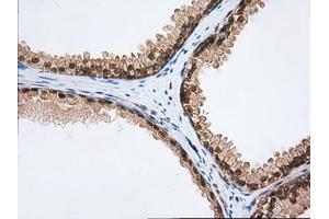 Immunohistochemical staining of paraffin-embedded Human Kidney tissue using anti-PDE4A mouse monoclonal antibody. (PDE4A antibody)