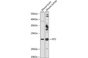 Western blot analysis of extracts of various cell lines, using NTS antibody (ABIN6128380, ABIN6144914, ABIN6144917 and ABIN6215934) at 1:3000 dilution. (Neurotensin antibody  (AA 24-148))