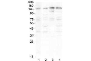 Western blot testing of human 1) A375, 2) HepG2, 3) Jurkat and 4) PANC-1 lysate with EPS15 antibody at 0. (EPS15 antibody)
