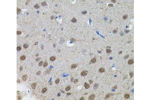 Immunohistochemistry of paraffin-embedded Rat brain using MYCN Polyclonal Antibody (MYCN antibody)