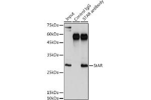 Immunoprecipitation analysis of 300 μg extracts of K-562 cells using 3 μg StAR antibody (ABIN3021302, ABIN3021303, ABIN3021304 and ABIN6214574). (STAR antibody  (AA 64-285))