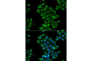 Immunofluorescence analysis of HeLa cell using CTNS antibody. (CTNS antibody)