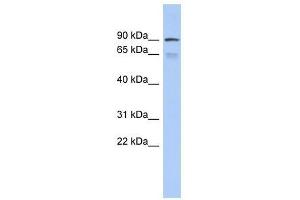 Western Blot showing ZNF791 antibody used at a concentration of 1-2 ug/ml to detect its target protein. (ZNF791 antibody  (Middle Region))