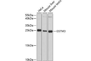 Western blot analysis of extracts of various cell lines, using GSTM3 antibody (ABIN1680137, ABIN3018259, ABIN3018260 and ABIN6220417) at 1:3000 dilution. (GSTM3 antibody  (AA 101-225))