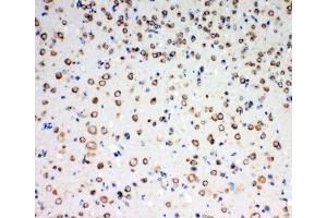 IHC-P: TrkC antibody testing of rat brain tissue (NTRK3 antibody  (AA 167-182))