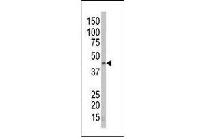 The anti-DAPK2 Pab is used in Western blot to detect DAPK2 in mouse lung tissue lysate. (DAPK2 antibody  (N-Term))