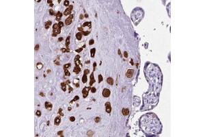 Immunohistochemical staining (Formalin-fixed paraffin-embedded sections) of human placenta with PTGES polyclonal antibody  shows cytoplasmic positivity in a subset of trophoblastic cells. (Prostaglandin E Synthase antibody)